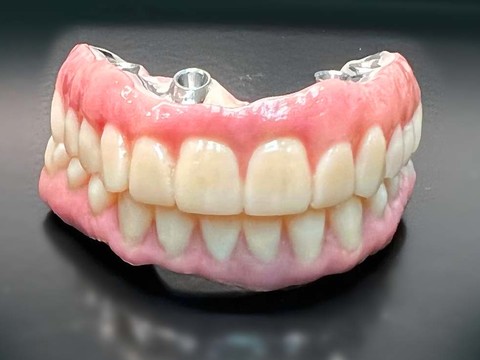 Фото стоматологии «Зуботехническая лаборатория, CAD/CAM» - Циркониевый протез All-on-4