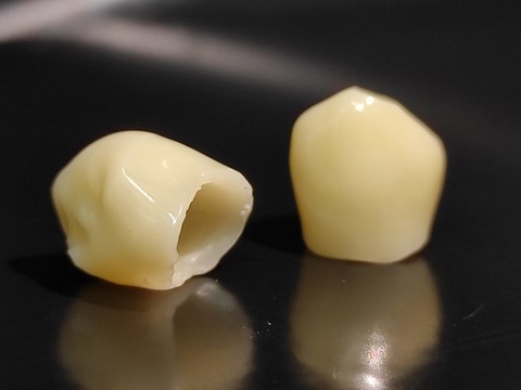 Фото стоматологии «Зуботехническая лаборатория, CAD/CAM» - Циркониевые коронки после глазурования
