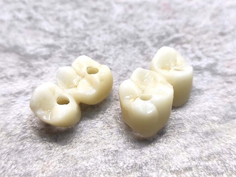 Фото стоматологии «Зуботехническая лаборатория, CAD/CAM» - Циркониевые коронки под винтовую фиксацию