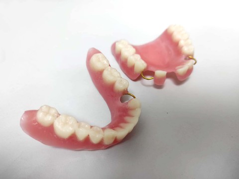 Фото стоматологии «Зуботехническая лаборатория, CAD/CAM» - Частичный съемный протез