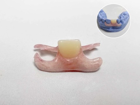 Фото стоматологии «Зуботехническая лаборатория, CAD/CAM» - Косметический протез